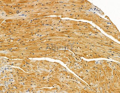 SLC10A4 Antibody - DF9931 at 1/100 staining mouse heart tissue by IHC-P.