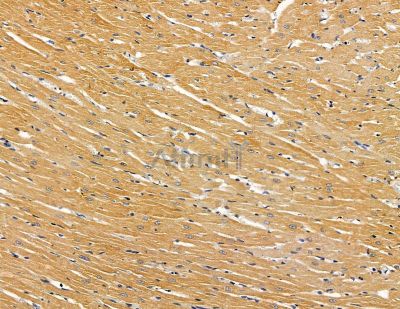 SLC10A4 Antibody - DF9931 at 1/100 staining rat heart tissue by IHC-P.