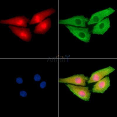 ZNF280D Antibody - DF9951 staining Hela cells by IF/ICC.