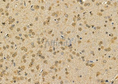 BTF3L3 Antibody - DF9973 at 1/100 staining rat brain tissue by IHC-P.