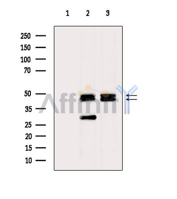 NFATc2IP Antibody - Western blot analysis of extracts from various samples, using NFATc2IP Antibody.