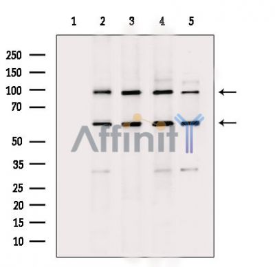 Filaggrin Antibody - Western blot analysis of extracts from various samples, using Filaggrin Antibody.