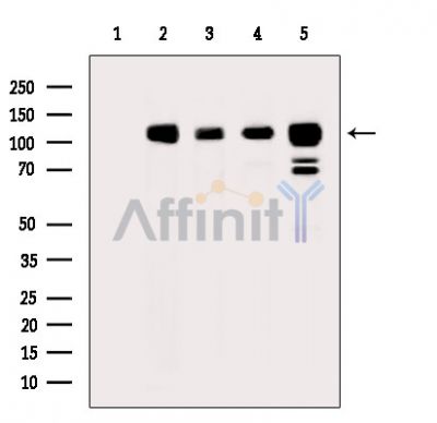 Calpastatin Antibody - Western blot analysis of extracts from various samples, using Calpastatin Antibody.