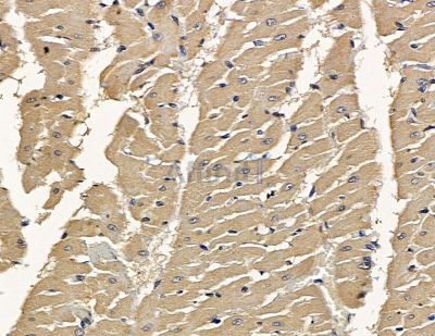 Calpastatin Antibody - DF13778 at 1/100 staining rat heart tissue by IHC-P.