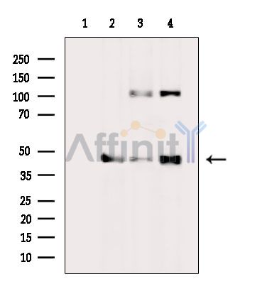 SPDEF Antibody - Western blot analysis of extracts from various samples, using SPDEF Antibody.