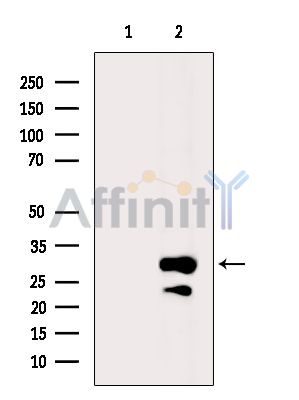 KHDC1 Antibody - Western blot analysis of extracts from HepG2 cells(heat-shock treatment), using KHDC1 Antibody.