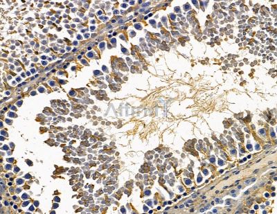 CCDC39 Antibody - DF13893 at 1/100 staining rat testis tissue by IHC-P.