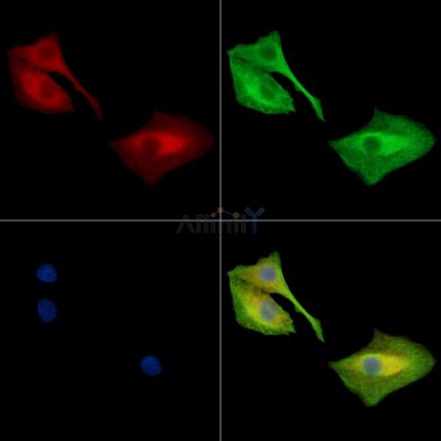 SH3PXD2B Antibody - DF13894 staining A549 cells by IF/ICC.