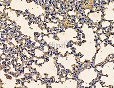 SBEM Antibody - DF13898 at 1/100 staining mouse lung tissue by IHC-P.