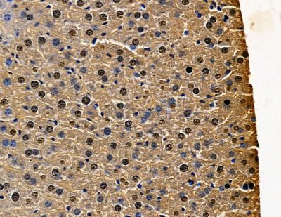 ELK3 Antibody - DF13900 at 1/100 staining mouse liver tissue by IHC-P.