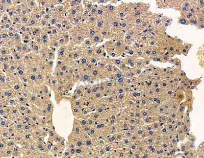 Synaptogyrin 2 Antibody - DF13913 at 1/100 staining mouse liver tissue by IHC-P.