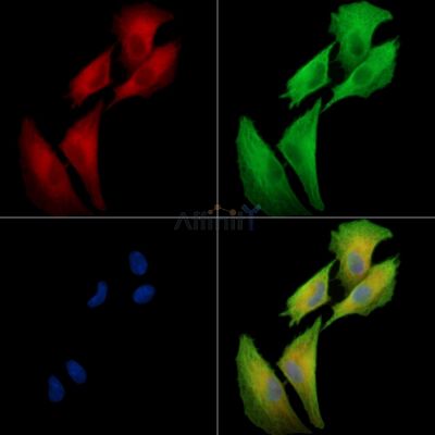Synaptogyrin 2 Antibody - DF13913 staining A549 cells by IF/ICC.