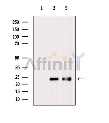 TMEM126A Antibody - Western blot analysis of extracts from various samples, using TMEM126A Antibody.