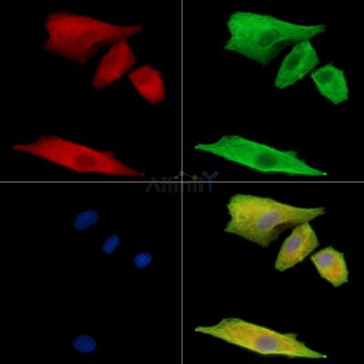 OTULIN Antibody - DF13917 staining A549 cells by IF/ICC.
