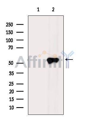 AMPS Antibody - Western blot analysis of extracts from HepG2 cells(heat-shock treatment), using Adenylosuccinate Lyase Antibody.