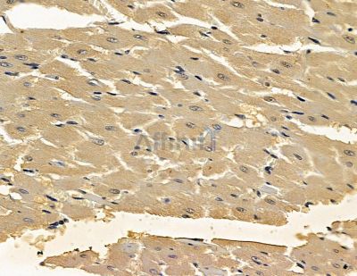 AMPS Antibody - DF13918 at 1/100 staining rat heart tissue by IHC-P.