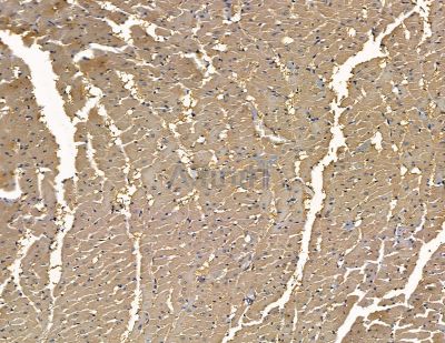 FbxO6 Antibody - DF13921 at 1/100 staining rat heart tissue by IHC-P.