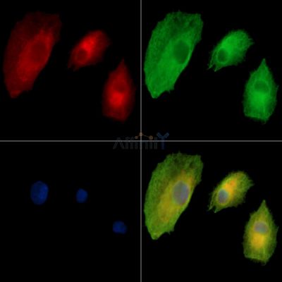 TTPA Antibody - DF13928 staining A549 cells by IF/ICC.