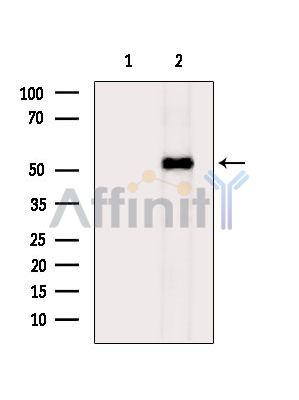 IRX3 Antibody - Western blot analysis of extracts from Hela cells(heat-shock treatment), using Iroquois homeobox protein 3 Antibody.