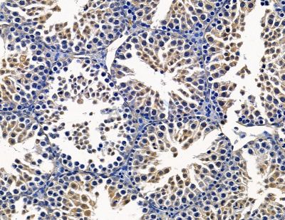 Spastin Antibody - DF13952 at 1/100 staining mouse testis tissue by IHC-P.
