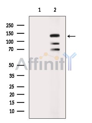 SUPT5H Antibody - Western blot analysis of extracts from Hela cells(heat-shock treatment), using SUPT5H Antibody.
