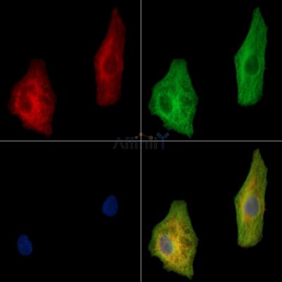 Mucolipin 1 Antibody - DF13980 staining A549 cells by IF/ICC.