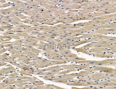 Mucolipin 1 Antibody - DF13980 at 1/100 staining rat heart tissue by IHC-P.