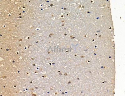 PARL Antibody - DF14001 at 1/100 staining mouse brain tissue by IHC-P.