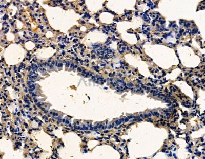 CCNO Antibody - DF14008 at 1/100 staining mouse lung tissue by IHC-P.