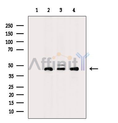 CHRNB2 Antibody - Western blot analysis of extracts from various samples, using CHRNB2 Antibody.