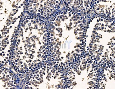 METRN Antibody - DF14021 at 1/100 staining mouse testis tissue by IHC-P.