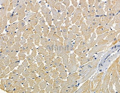 SLC38A4 Antibody - DF14025 at 1/100 staining rat heart tissue by IHC-P.