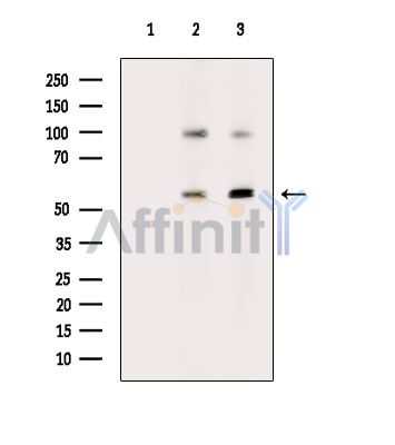 Chimaerin 2 Antibody - Western blot analysis of extracts from Hela cells(heat-shock treatment)HepG2 cells(heat-shock treatment), using Chimaerin 2 Antibody.