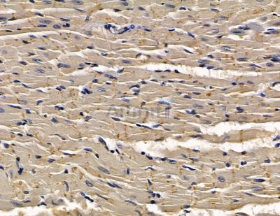 Chimaerin 2 Antibody - DF14029 at 1/100 staining rat heart tissue by IHC-P.