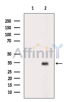 SLC25A38 Antibody - Western blot analysis of extracts from HepG2 cells(heat-shock treatment), using SLC25A38 Antibody.