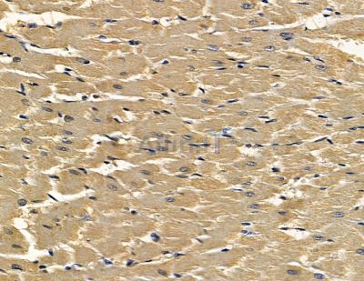 DLAT Antibody - DF14046 at 1/100 staining rat heart tissue by IHC-P.