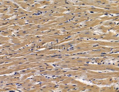 CLIC5 Antibody - DF14048 at 1/100 staining rat heart tissue by IHC-P.