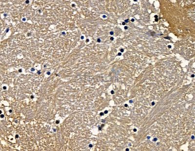 LOXL1 Antibody - DF14089 at 1/100 staining mouse brain tissue by IHC-P.