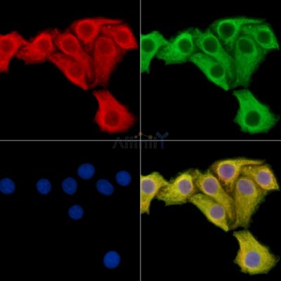 CACNB2 Antibody - DF14574 staining Hela cells by IF/ICC.