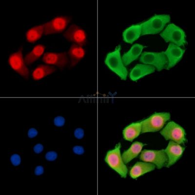 MEX3A Antibody - DF14699 staining Hela cells by IF/ICC.