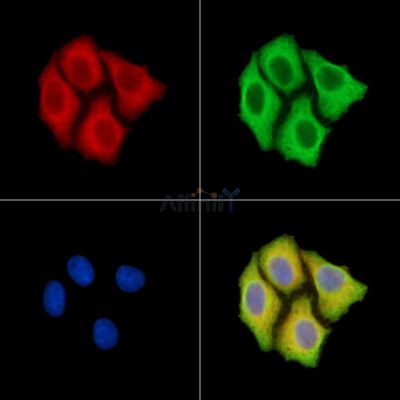 PLA2R1 Antibody - DF14705 staining Hela cells by IF/ICC.