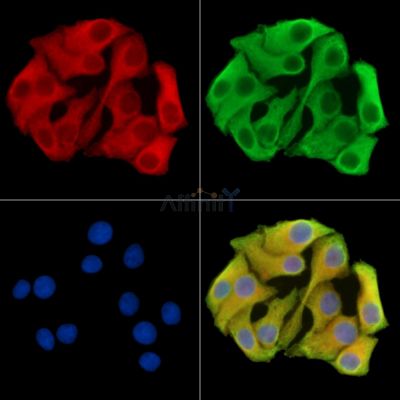 FJX1 Antibody - DF14709 staining Hela cells by IF/ICC.