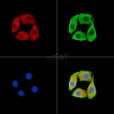 RNF170 Antibody - DF14713 staining Hela cells by IF/ICC.