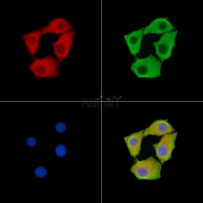 SARAF Antibody - DF14716 staining Hela cells by IF/ICC.