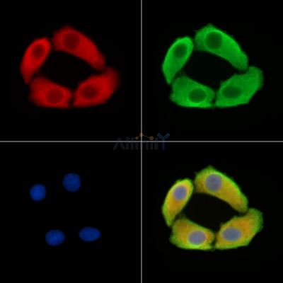 SLPI Antibody - DF14728 staining Hela cells by IF/ICC.