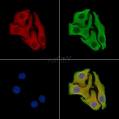 ANO3 Antibody - DF14731 staining Hela cells by IF/ICC.
