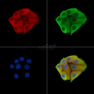 MTX2 Antibody - DF14737 staining Hela cells by IF/ICC.