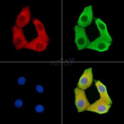 SSX6 Antibody - DF14739 staining Hela cells by IF/ICC.