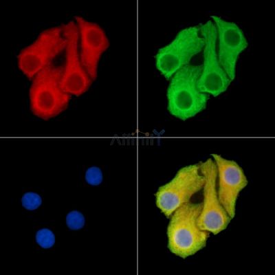 SLC41A1 Antibody - DF14741 staining Hela cells by IF/ICC.