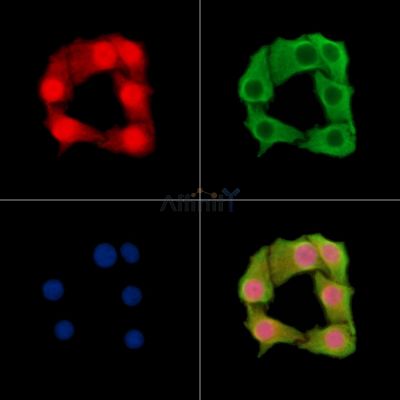 SLC39A11 Antibody - DF14747 staining Hela cells by IF/ICC.
